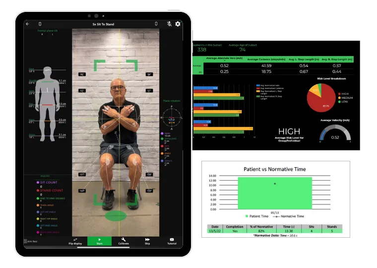 Kinetisense Movement Analysis at Albany Physio